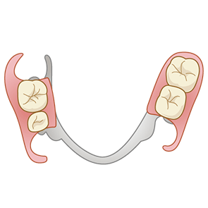 部分入れ歯のイラスト